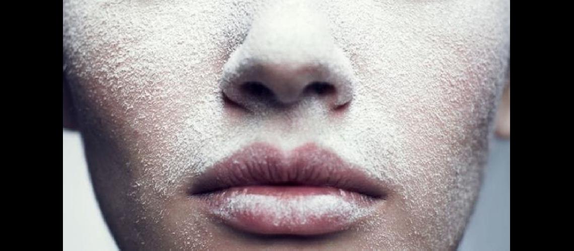  En invierno la piel luce deshidratada opaca y sensible a causa de las temperaturas (iStock)