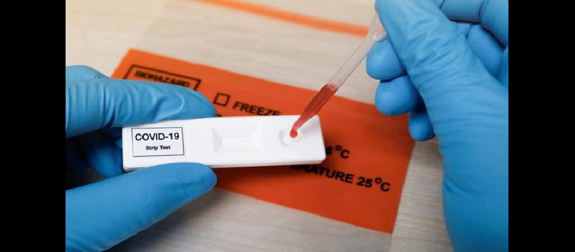   El diagnóstico por Test de Antígeno est avalado por el Ministerio de Salud de la Nación y la Provincia  (GACETA MEDICA)