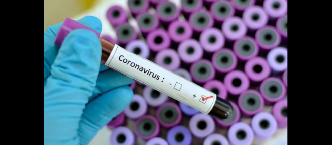  En las últimas 24 horas se hicieron 43 hisopados por casos sospechosos de coronavirus (ARCHIVO LA OPINION)