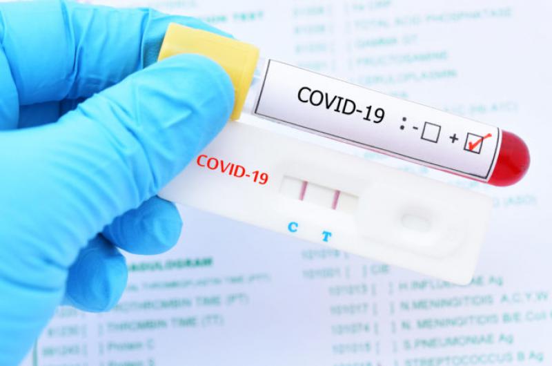 Los test de Covid clave para luchar contra la pandemia 
