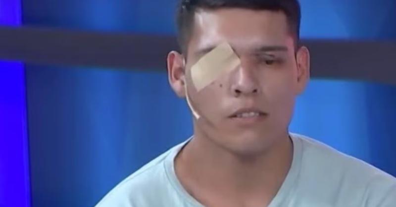 La pérdida del ojo derecho es irreversible para el joven que tenía fuerte vocación policial