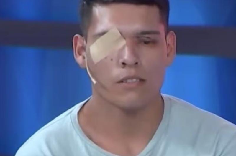 La pérdida del ojo derecho es irreversible para el joven que tenía fuerte vocación policial